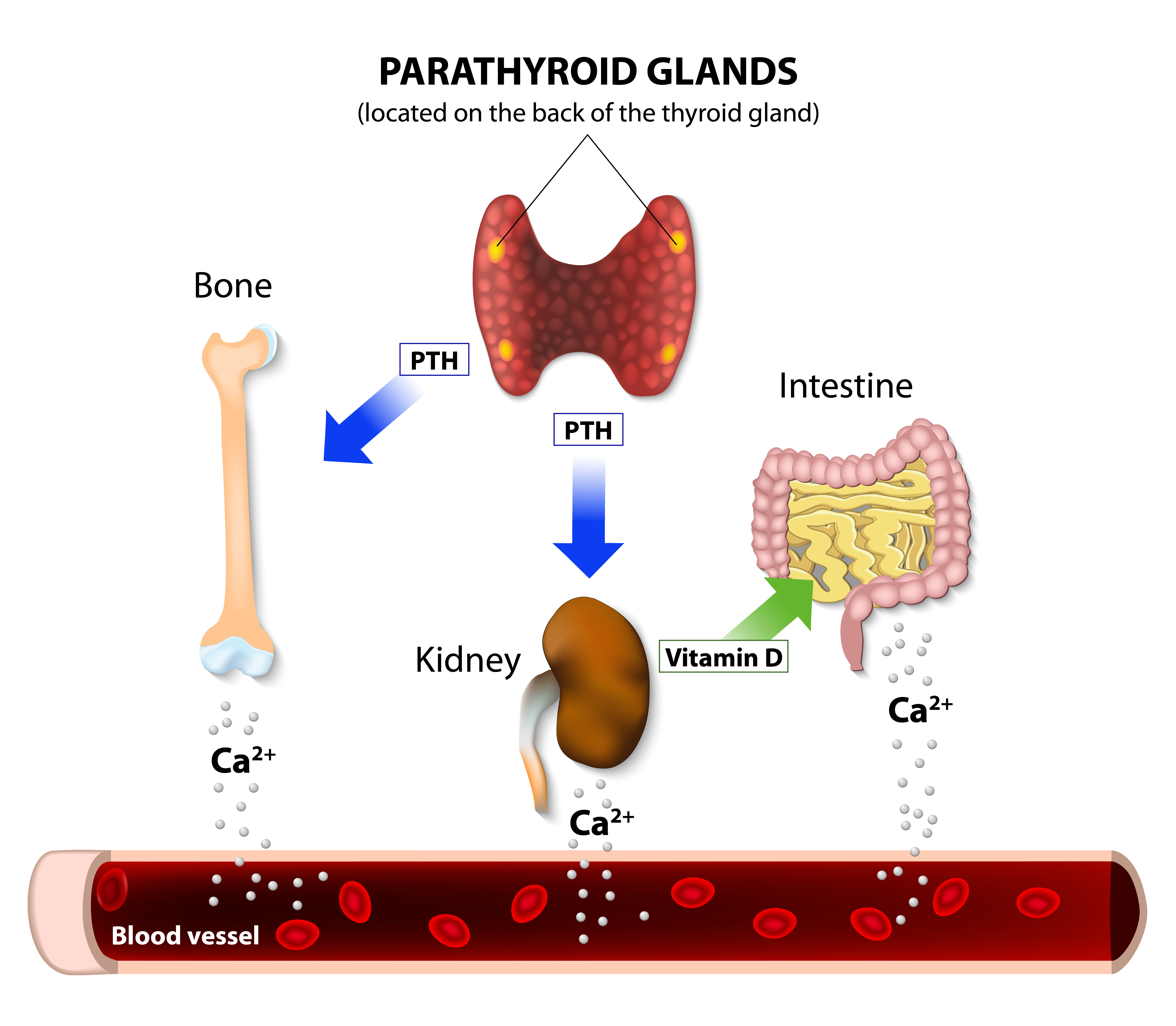 Hyperactive Parathyroid May Trouble Women with Fibromyalgia, Study